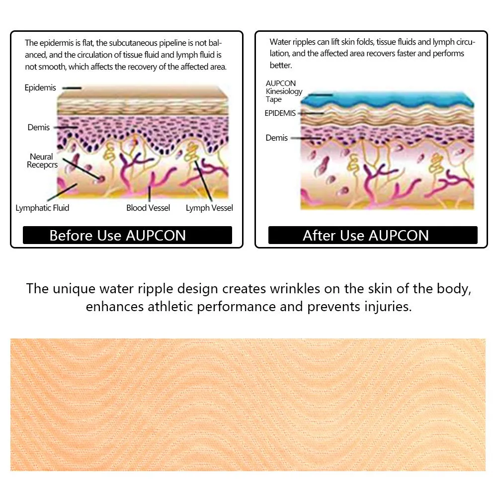 AUPCON Pre-Cut Kinesiology Athletic Tape Recovery Sports Cotton Elastic Adhesive Strain Injury Fitness Run Knee Muscle 5CM*5M(2*Beige) Beige